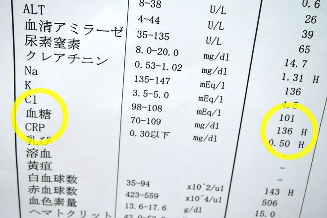 血糖値が136