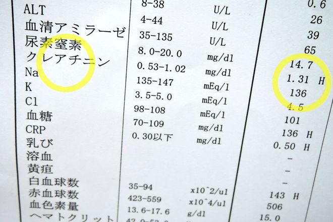 血液検査の結果表