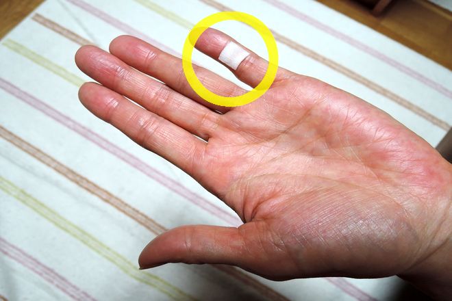 小指湿布は手のひら側の第一関節と第二関節の間に貼ります。