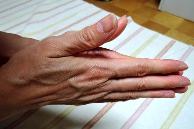 塩化アルミニウム液を手のひら全体に染みこませます。