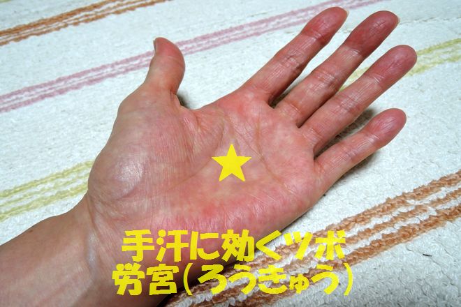 手汗に効くツボ|労宮(ろうきゅう)の位置と押し方を画像で解説