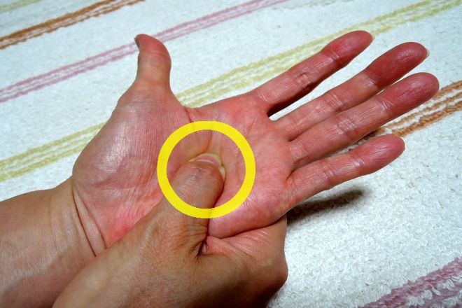 労宮を押すときの注意点