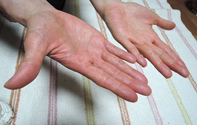 さらさらの手のひら