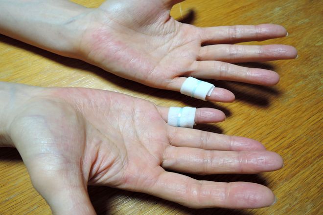 小指湿布は手汗を軽減させる効果があります。