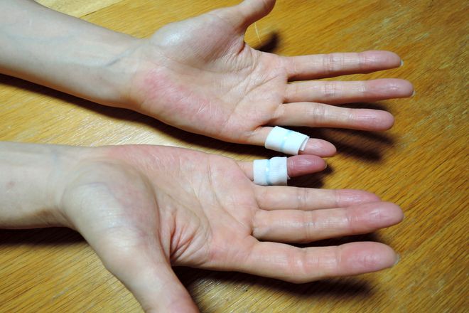 両手の小指に小指湿布を巻くとこんな感じになります。